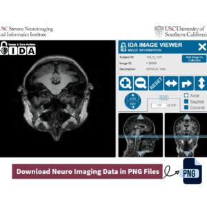 Convert NeuroImaging Data .NII Files to .PNG Files for Machine Learning