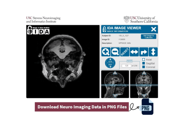 Convert NeuroImaging Data .NII Files to .PNG Files for Machine Learning